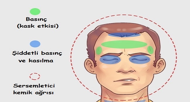 baş ağrısı tipleri ve tedavi yöntemleri
