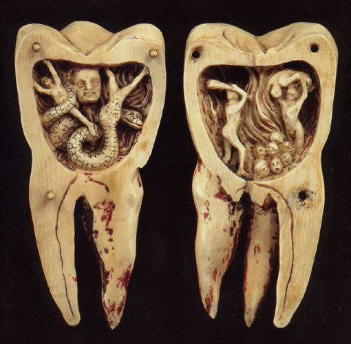 diş solucanı